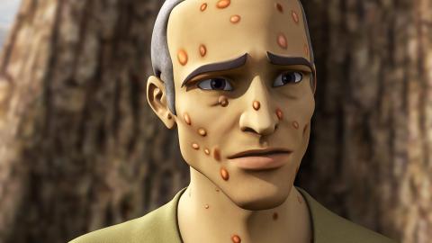 Job has boils all over his body